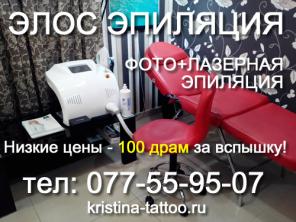 ЭЛОС эпиляция в Ереване | Фотоэпиляция в Ереване